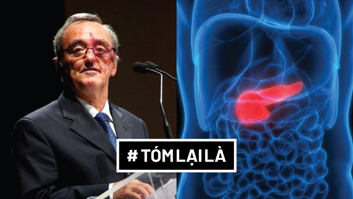 Đã tìm ra phương pháp chữa bệnh ung thư tuyến tụy?