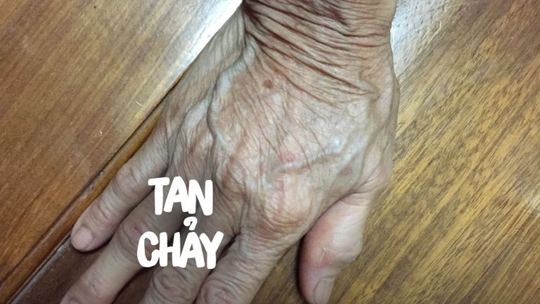 Nguồn ảnh: C.