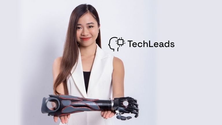 Trịnh Khánh Hạ, or Ella to many, has made it her life goal to empower every amputee in the country. | Source: Ella Trịnh